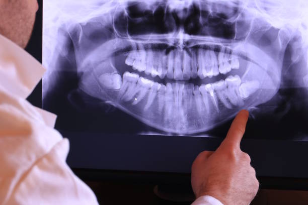 Best Dentist for Tooth Abscess  in Guernsey, WY